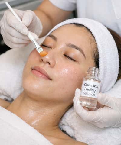 Facial Chemical Peeling - Nila Sundari 