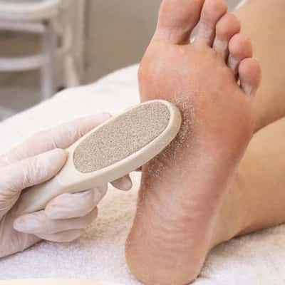 Pedicure callus treatment - Liana Putri