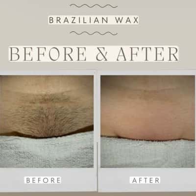 Brazilian waxing - Niluh Putu Ariani