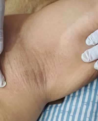 Waxing dan ipl - Nia Home Service Beauty Spa Beauty Spa