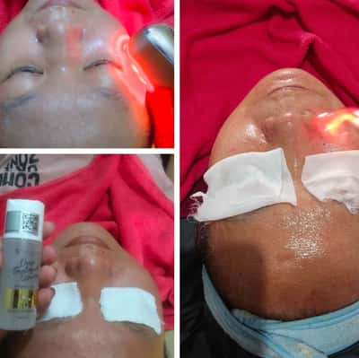 Facial komplit - Tiara Homecare Solo Tiara.